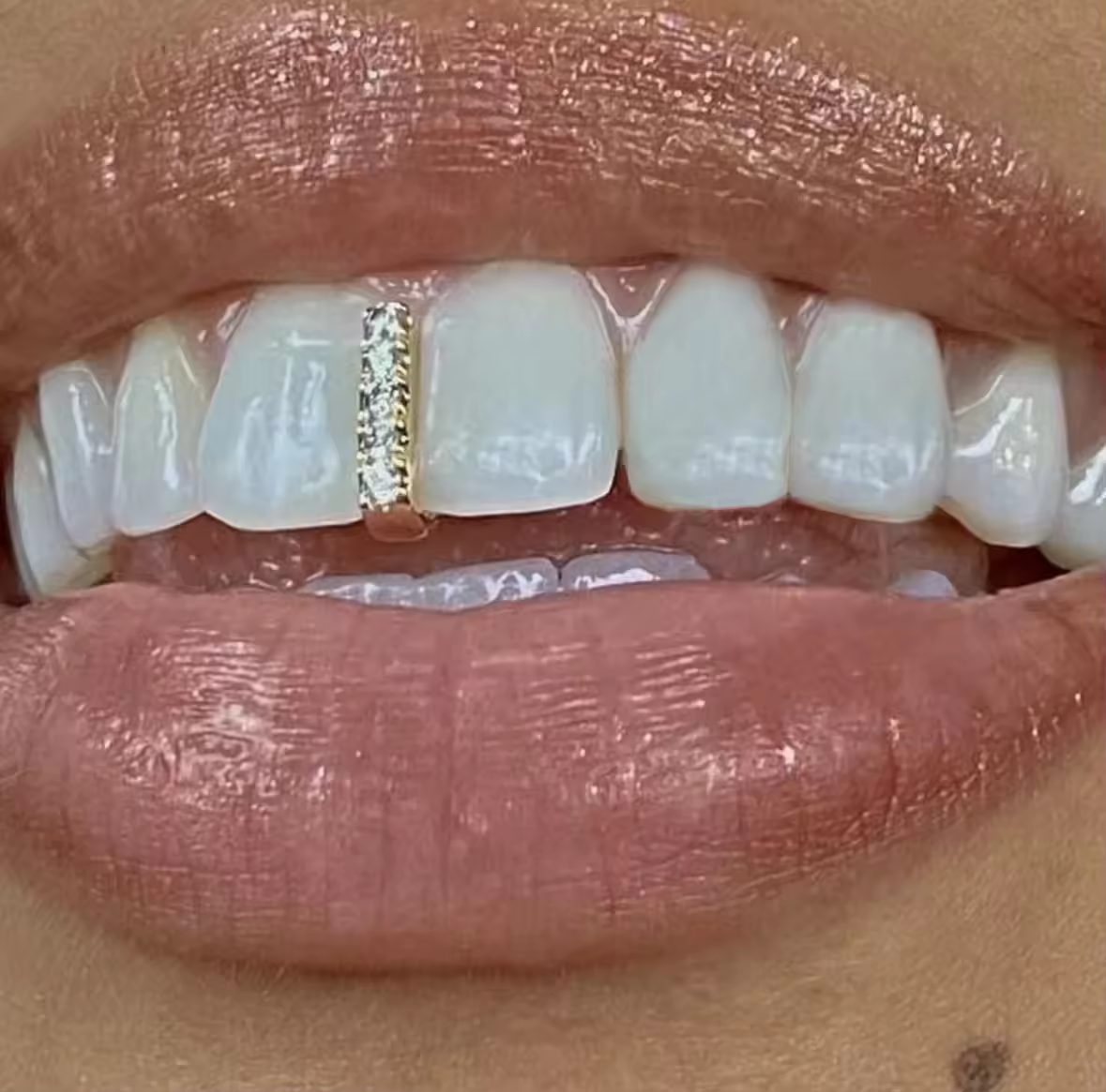 Plated Iced out streep tand