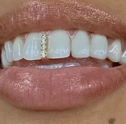 Plated Iced out streep tand